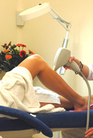 Depliacja laserowa - Kosmedica